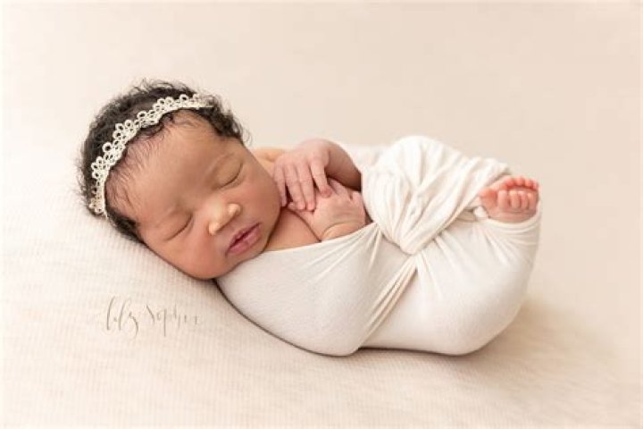Are babies born with beauty marks?