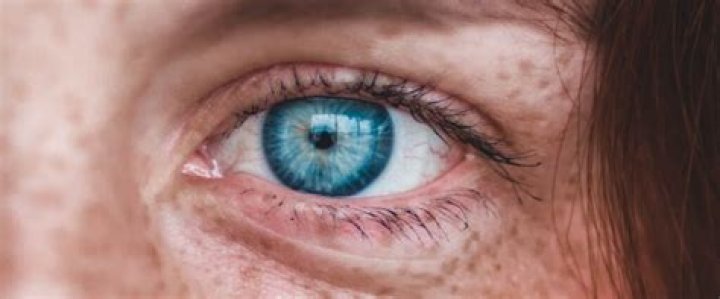 Are blue eyes becoming rare?