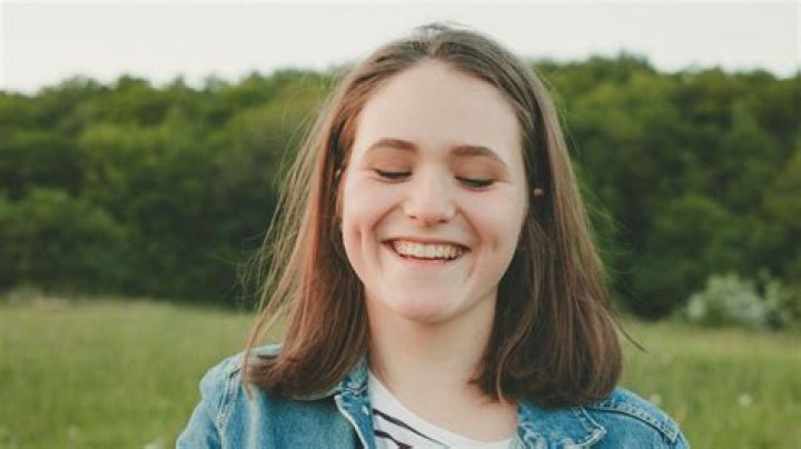 Are dimples forever?