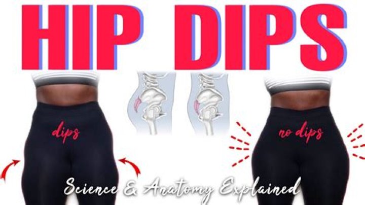 Are hip dips rare?
