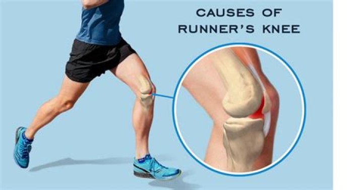Are most runners thin?