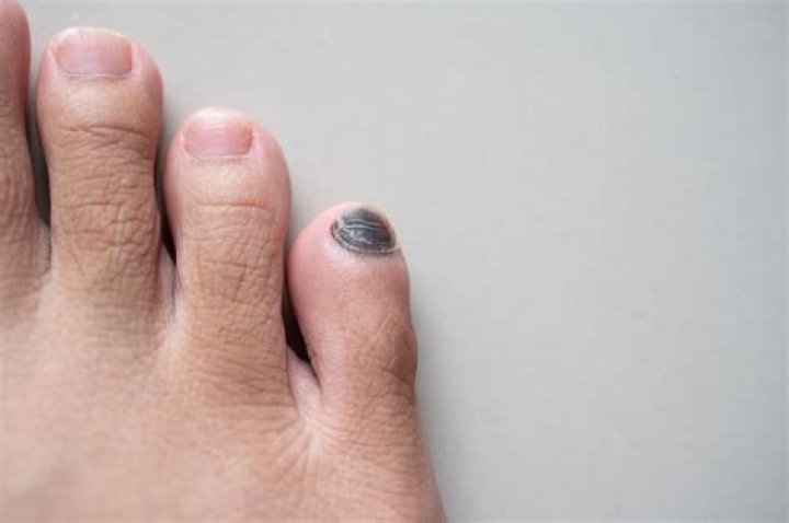 Are toenails alive?