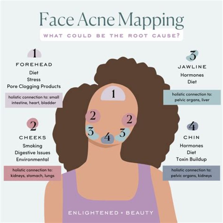Are you less attractive with acne?
