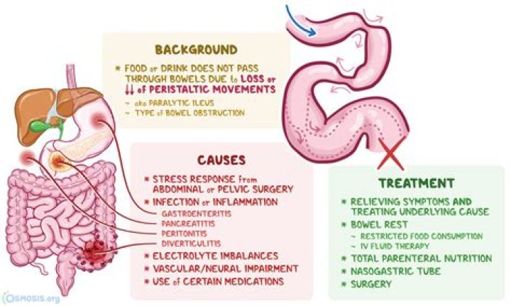Can a bowel blockage cause sepsis?