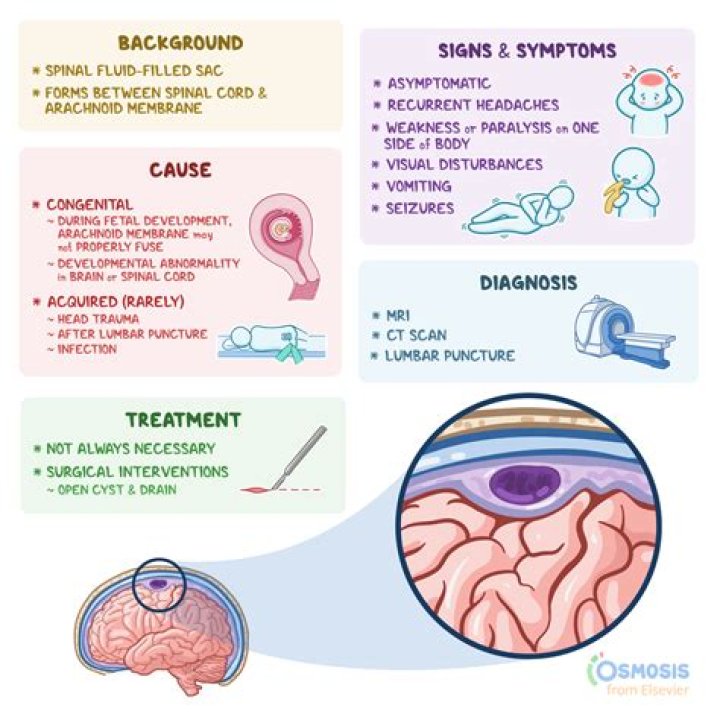 Can Ambien cause permanent memory loss?