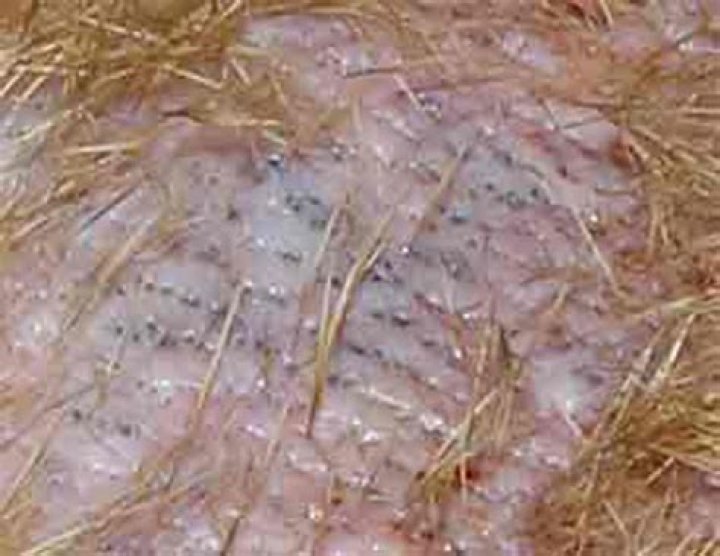 Can bird mites live in human hair?