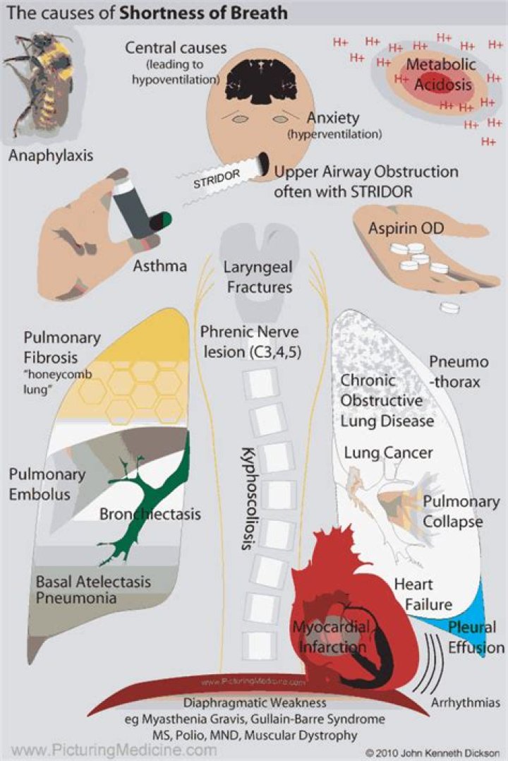 Can cholecystitis cause shortness of breath?