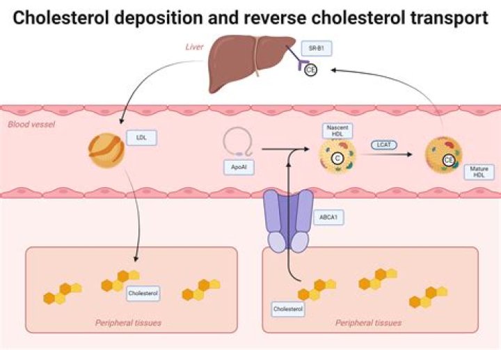 Can cholesterol reversed?
