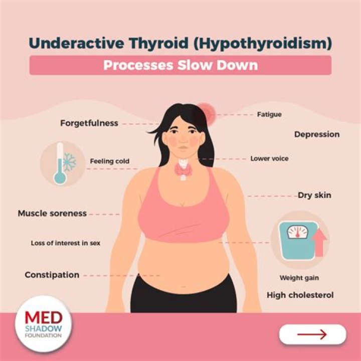 Can cold showers help hypothyroidism?