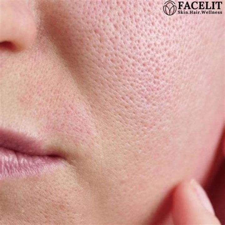 Can Colgate remove pores on face?