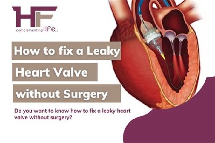 Can CT scan show leaky heart valve?