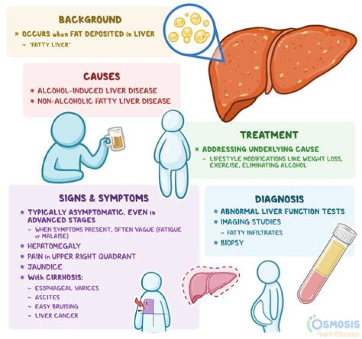 Can fatty liver be mistaken for cirrhosis?
