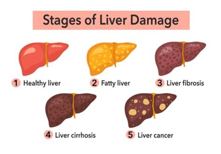 Can fatty liver disease cause sudden death?