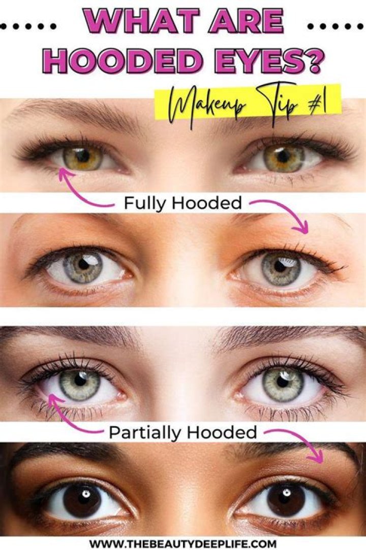 Can fillers help hooded eyes?