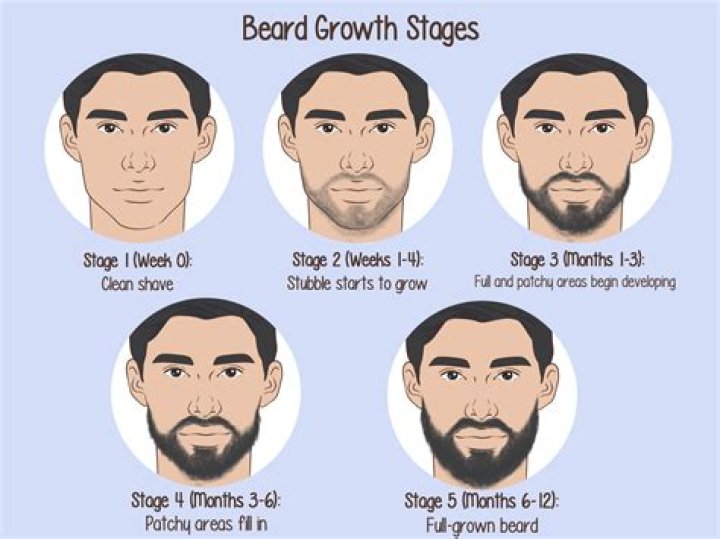 Can Gardaí have beards?