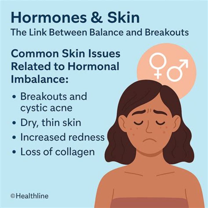 Can hormone imbalance affect your skin?