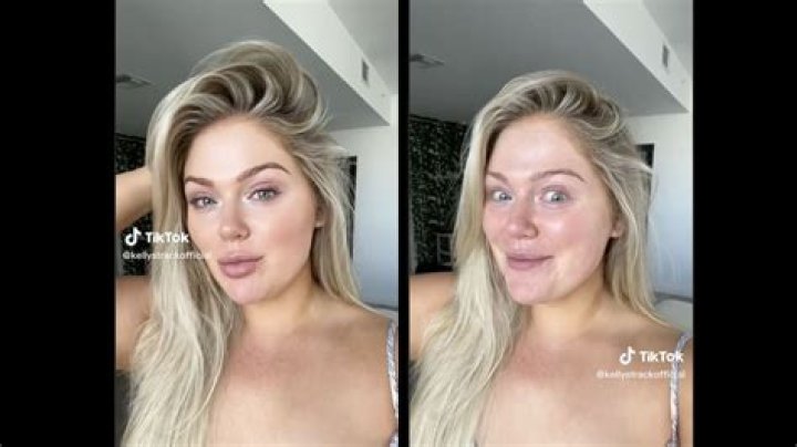 Can I become white by surgery?