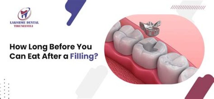 Can I eat after a filling?
