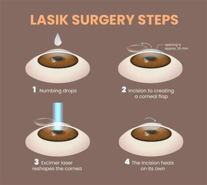 Can I eat before LASIK?