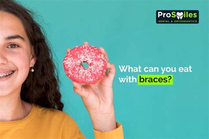 Can I eat cheese with braces?