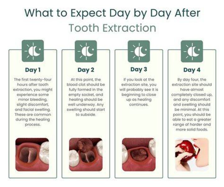 Can I eat tuna after tooth extraction?