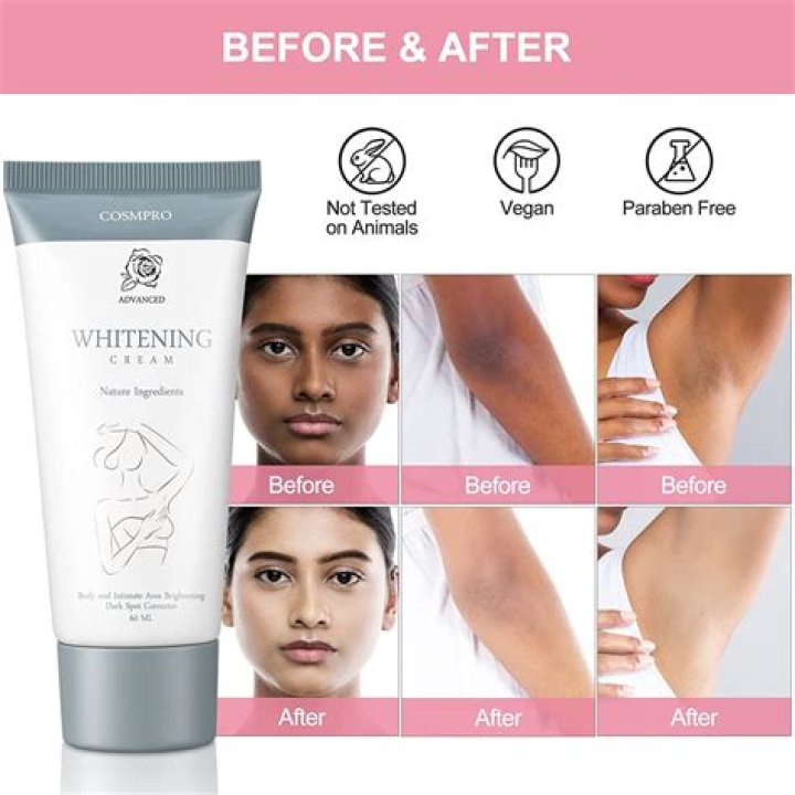 Can I use bleaching cream on my lips?