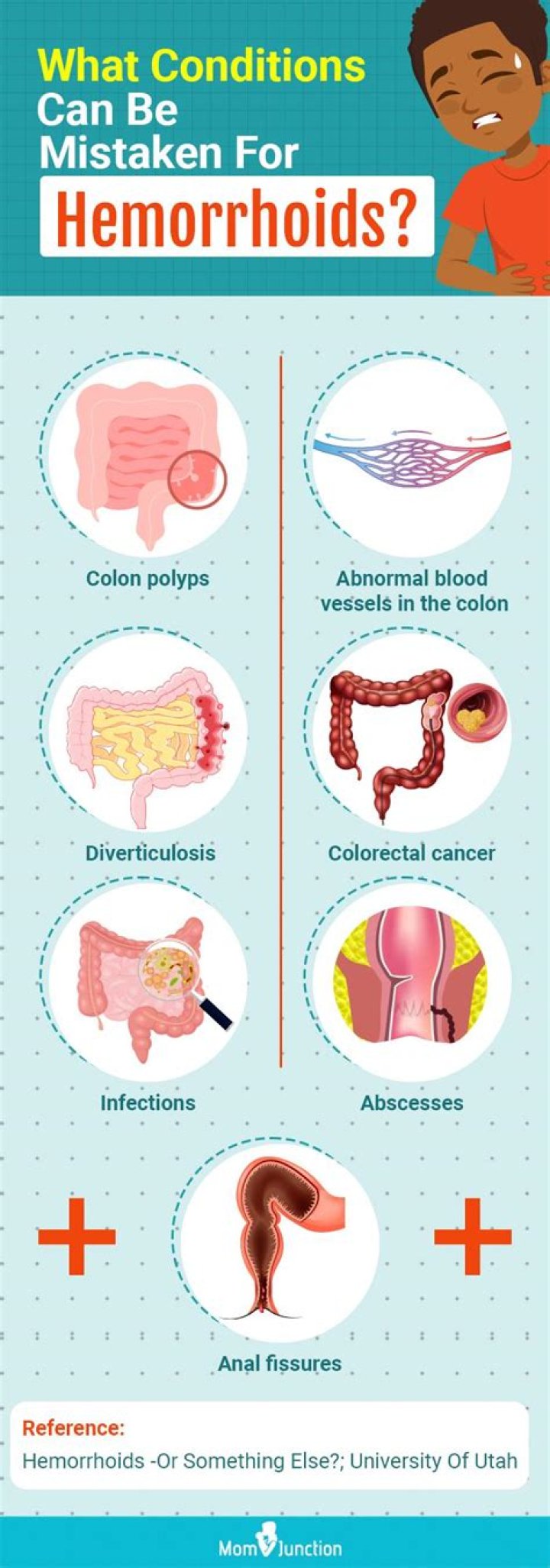 Can internal hemorrhoids make you feel like you have to poop?