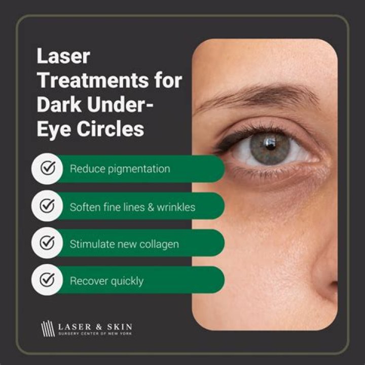 Can laser treatment help under eye bags?