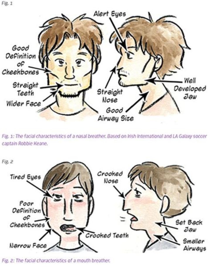 Can mouth breathing cause ADHD?