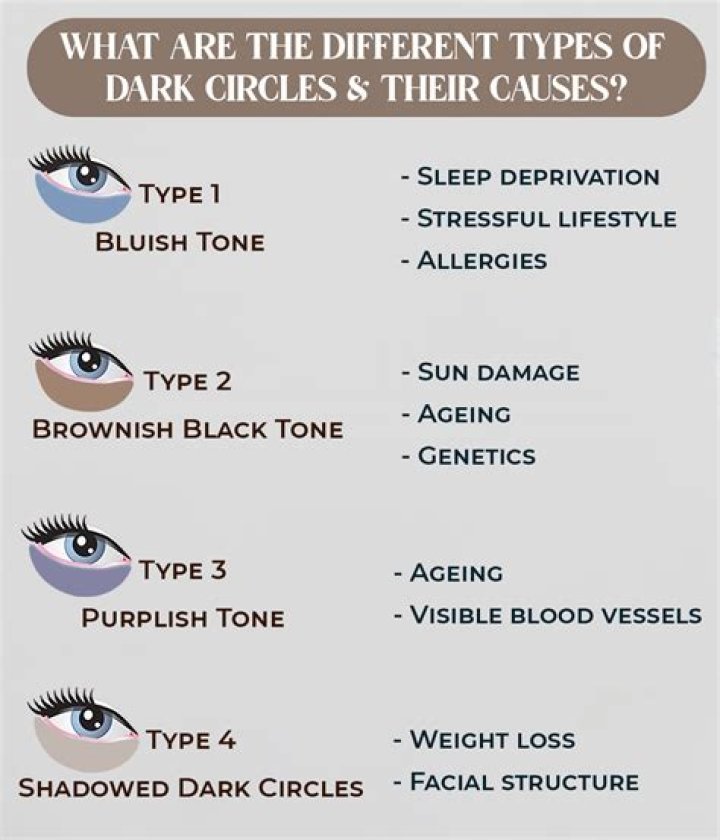Can oversleeping cause dark circles?
