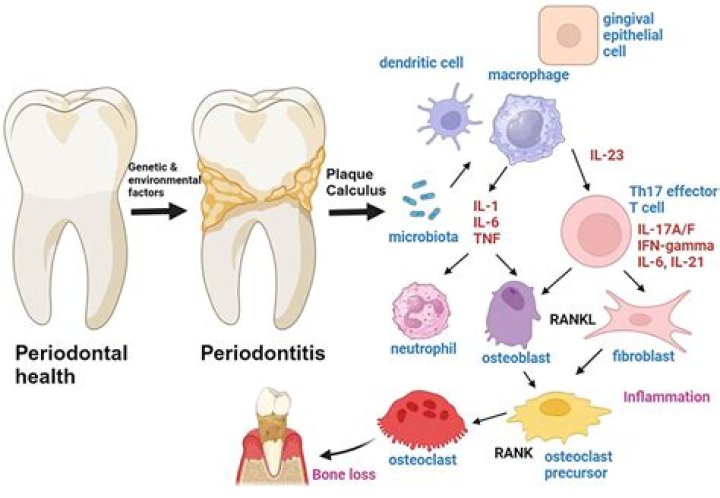 Can periodontitis be misdiagnosed?