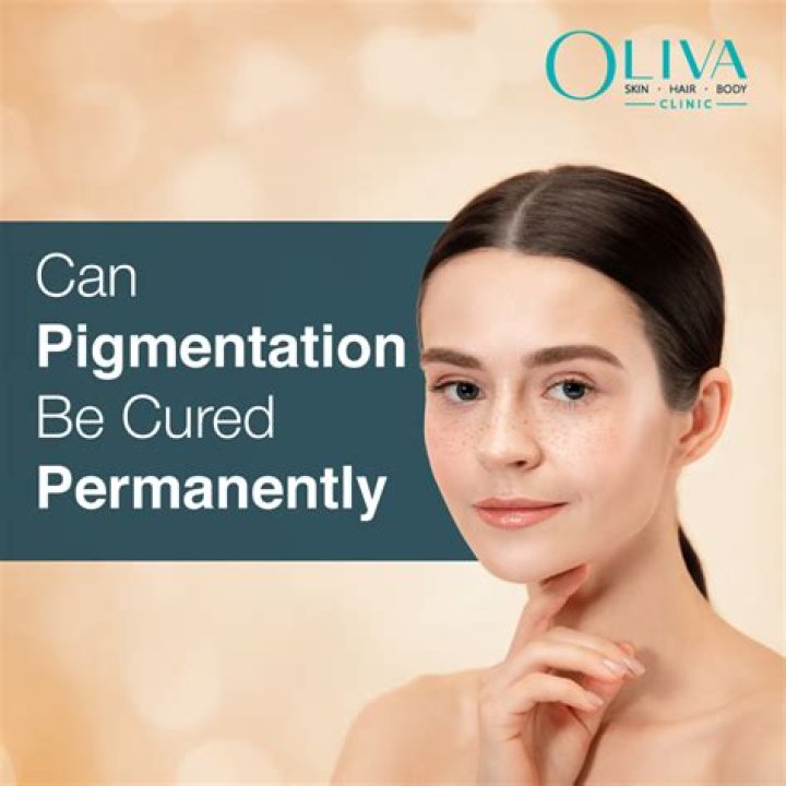 Can pigmentation be cured permanently?