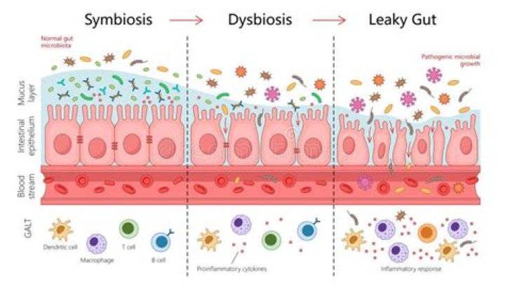 Can probiotics make leaky gut worse?