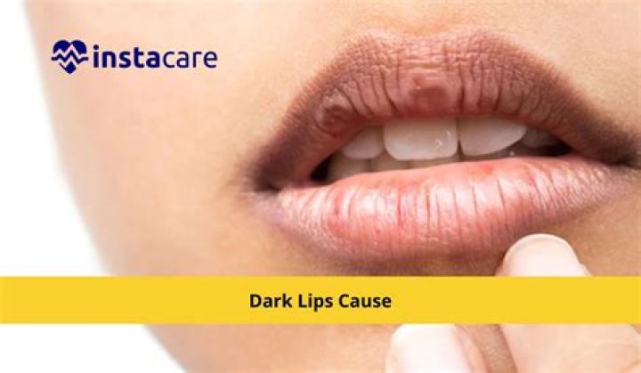 Can saliva cause dark lips?