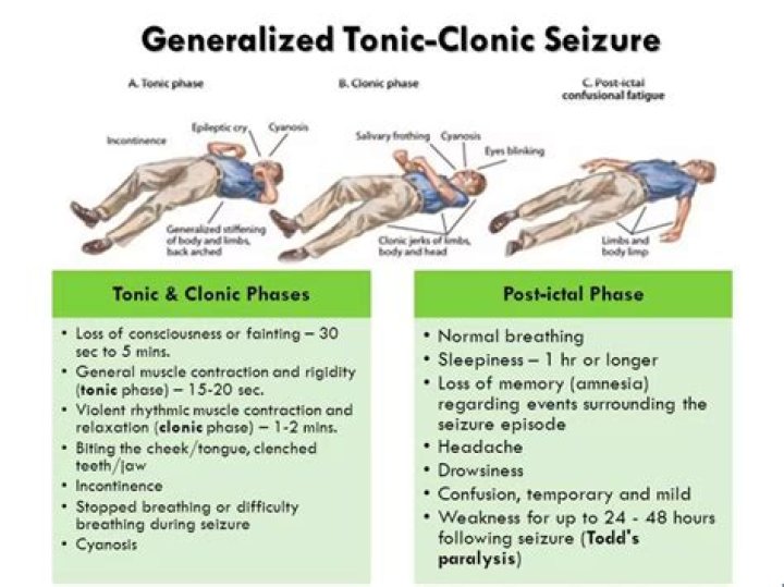 Can seizures cause crying?