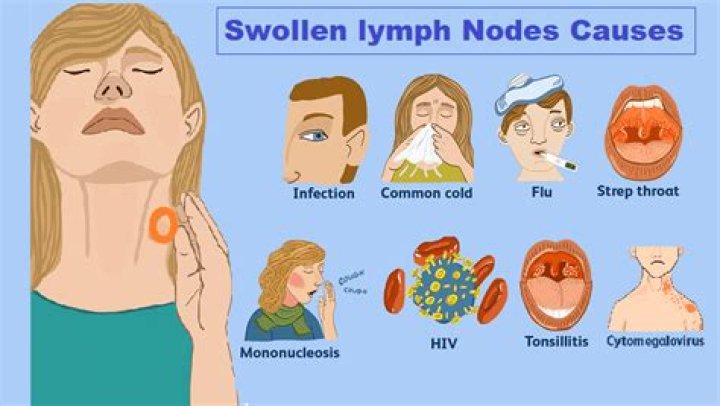 Can sinus problems cause swollen lymph nodes?