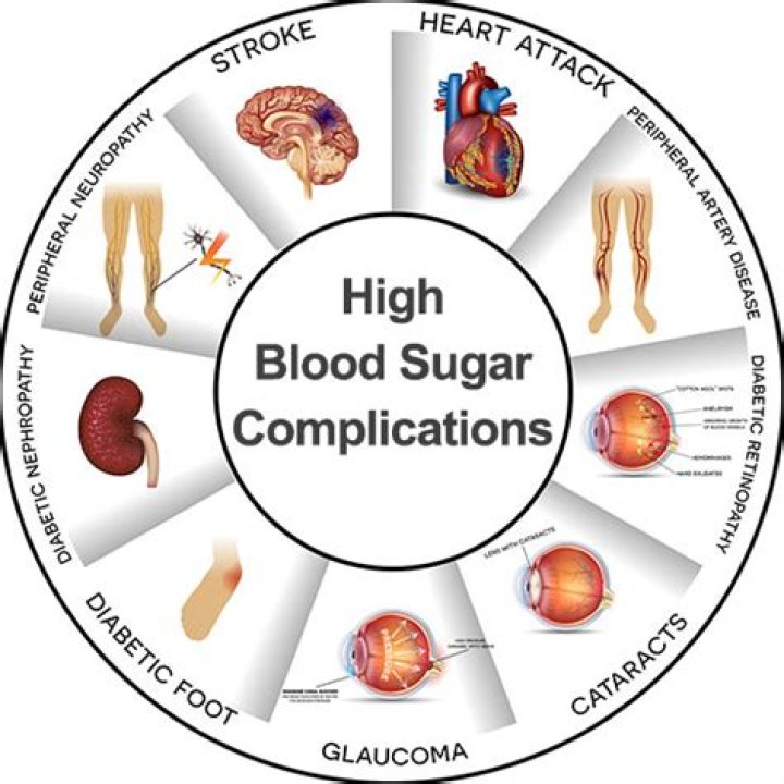 Can sleeping late cause high blood sugar?