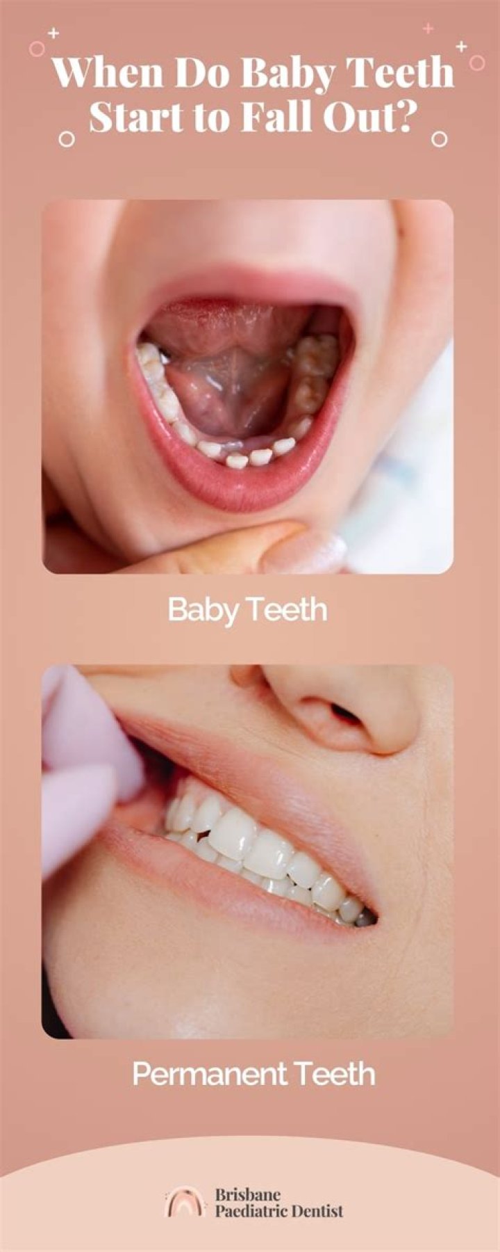 Can teeth fall out due to stress?
