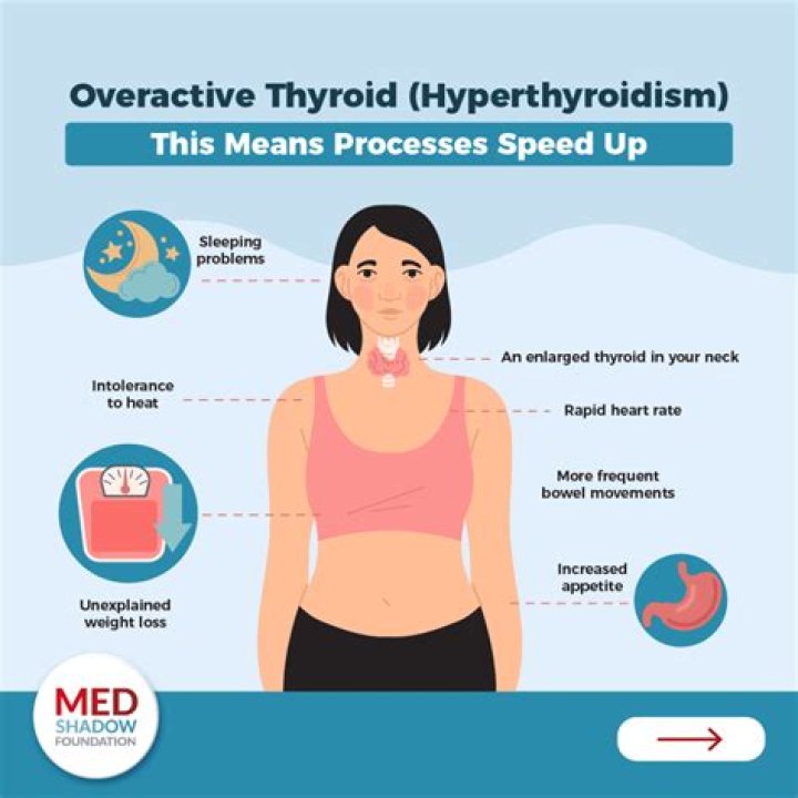 Can thyroid affect sleep?