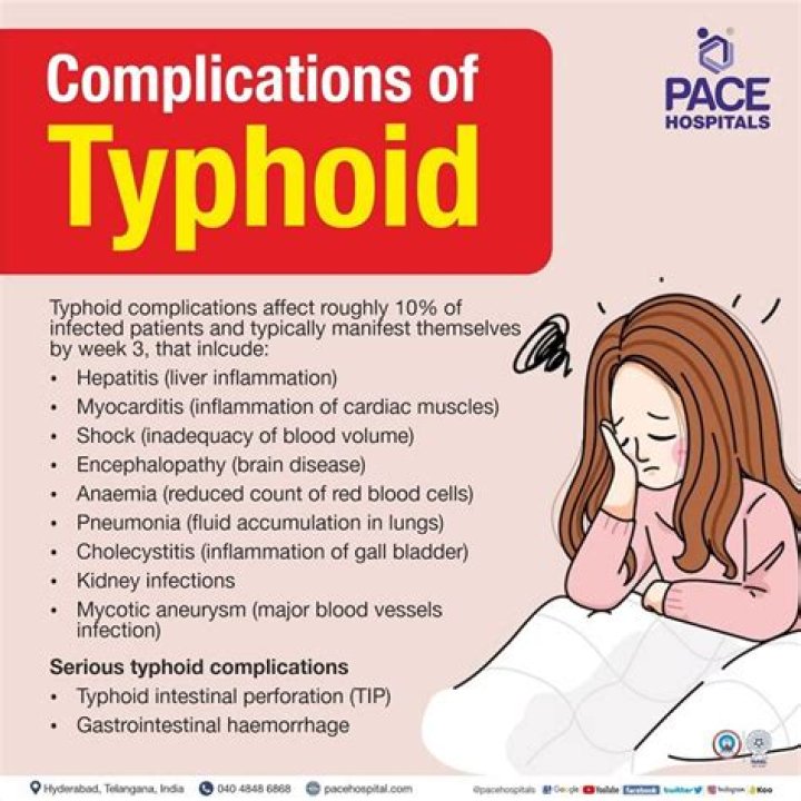 Can typhoid patient eat rice?