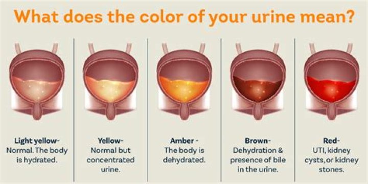 Can urine come out of bowel?