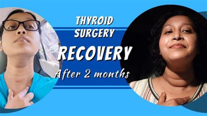 Can you develop hypothyroidism after surgery?
