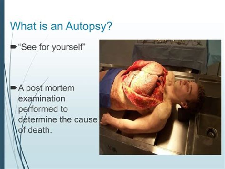 Can you do an autopsy after cremation?