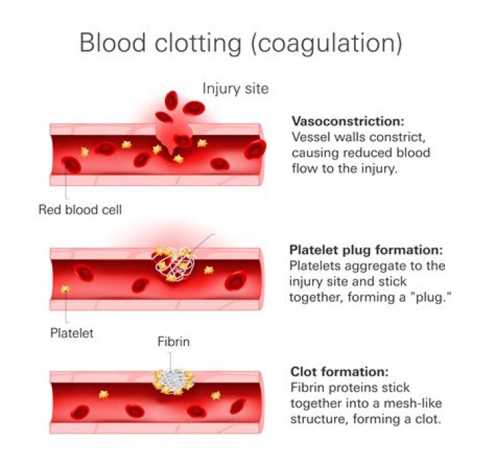 Can you get a blood clot while sleeping?