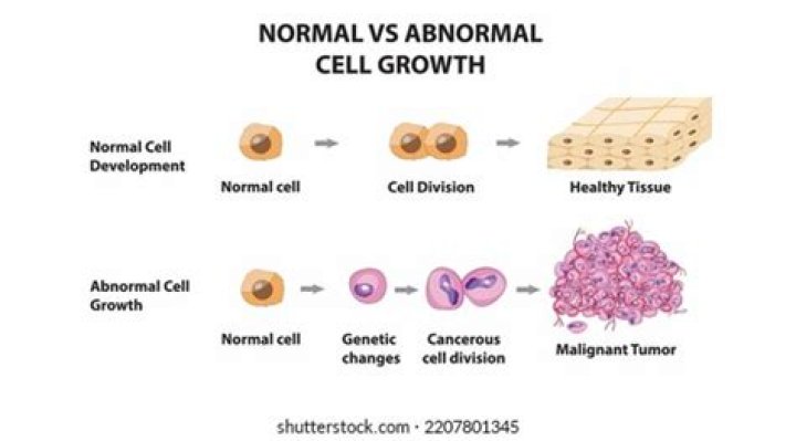 Can you get abnormal cells twice?