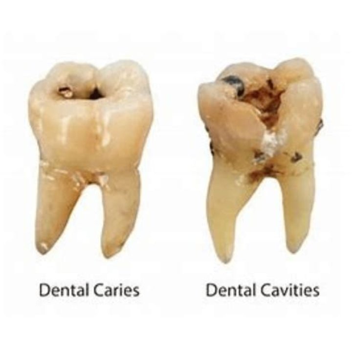 Can you get cavities at any age?