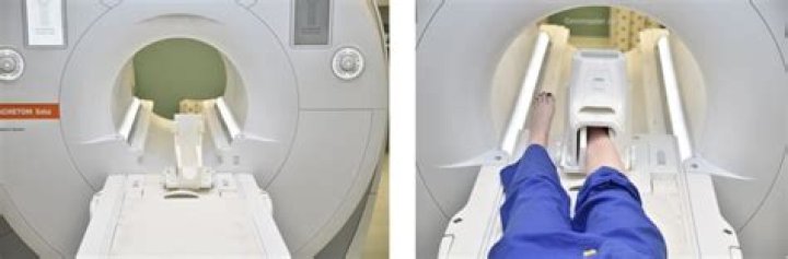 Can you go in an MRI feet first?