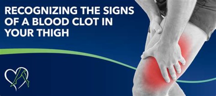 Can you massage a leg with a blood clot?