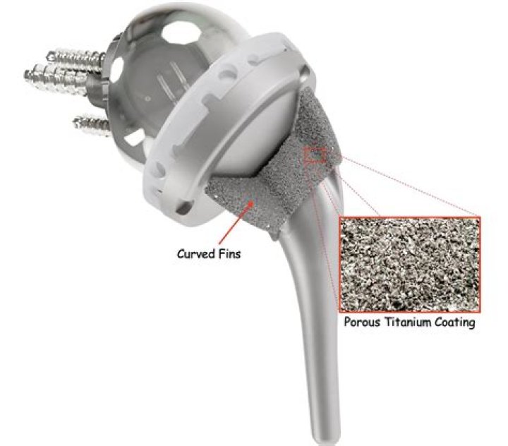 Can you repair a titanium frame?