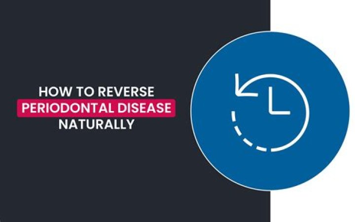 Can you reverse periodontal disease naturally?